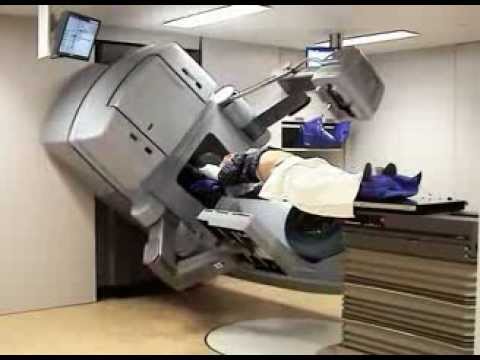 Radioterapia Guiada por Imagen - YouTube