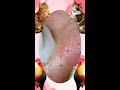 Blackheads Removal | Acne Treatment and Very Satisfying Satisfying Pimple pop #blackheads