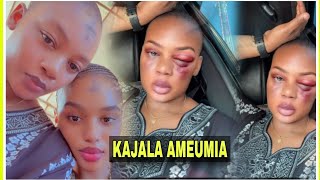 Picha za Kajala na Makovu Usoni Zavuja: Ameumia Vibaya, Chanzo Bado Hakijafahamika