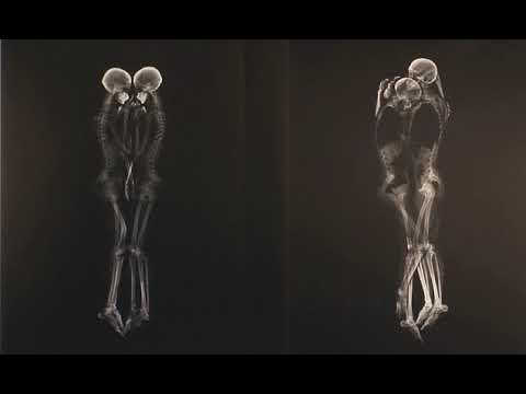 Video: Kvindelige Reproduktive Nerver & Vaskulaturdiagram - Body Maps