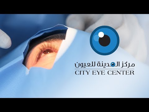    مركز المدينة للعيون