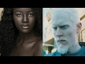 5 People with Unique Skin Color