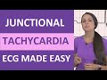 Understanding Junctional Tachycardia