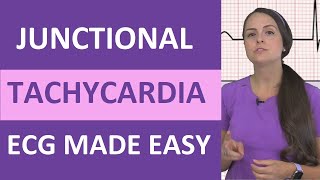 Junctional Tachycardia Ecg Interpretation Made Easy For Nclex Nursing School