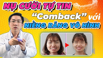Niềng Răng Vô Hình | Bí Quyết Để Có Nụ Cười Tự Tin