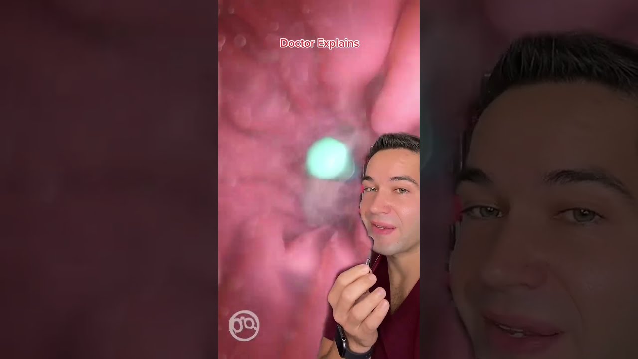 You Ve Been Swallowing Wrong Doctor Explains Correct Way To Take Pills