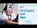 C5-C6 Spinal Cord Injury Patient Youssef Talks About His Epidural Stimulation Experience