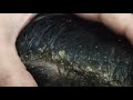 Dandruff Removal Big Flakes!! Dandruff Scratching Satisfying!!(Psoriasis flakes)!