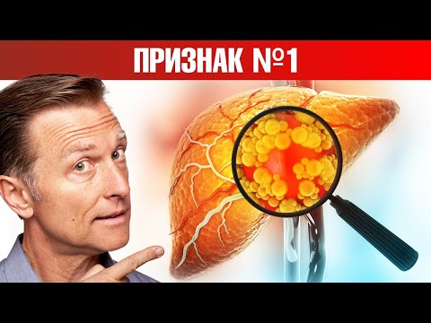 Видео: Dog Bloat: Симптоми, причини, лечение и превенция