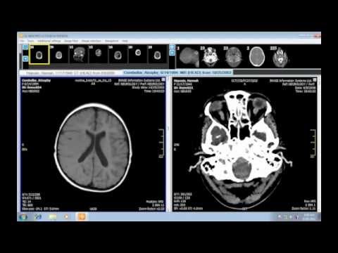 iQ-VIEW - The Radiology Reading Station