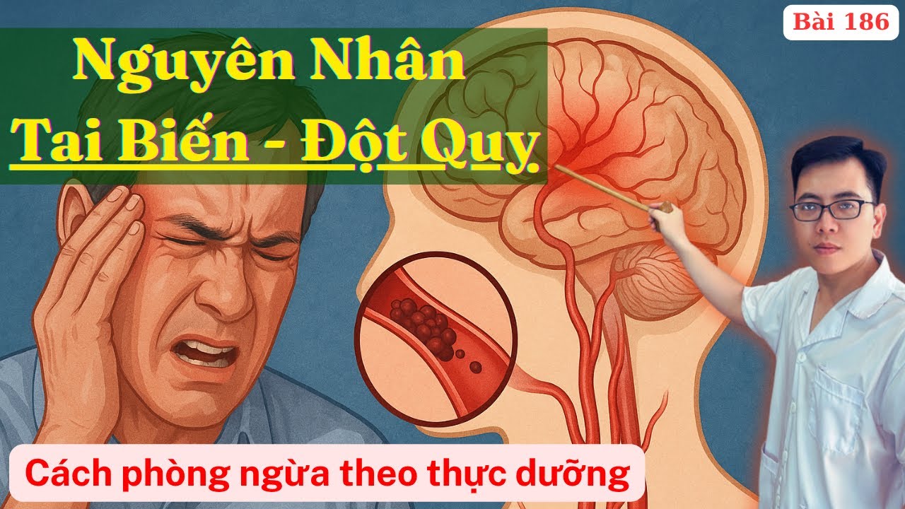 Tại sao bạn lại bị ĐỘT QUỴ - TAI BIẾN? Cách phòng ngừa ĐỘT QUỴ theo thực dưỡng hiện đại