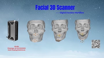 2. Thunk3D Facial 3D Scanner Digital Facebow Workflow