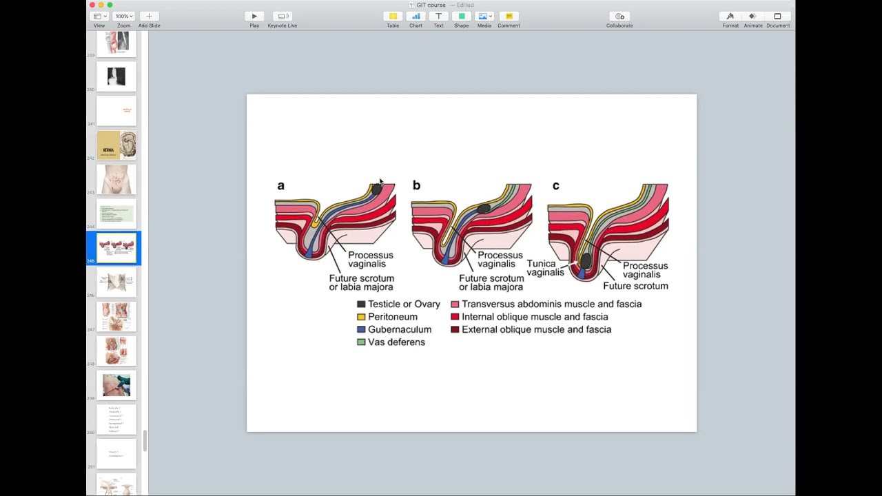 Hernia: Part 1 - General Surgery Course (4th + 6th Stages)