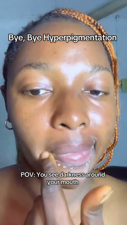 The secret to fading hyperpigmentation #marynmay #skincarereview