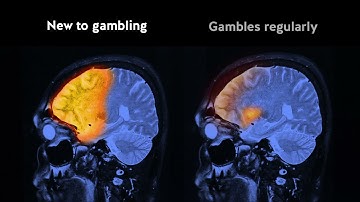 How the brain changes with gambling - 15secs