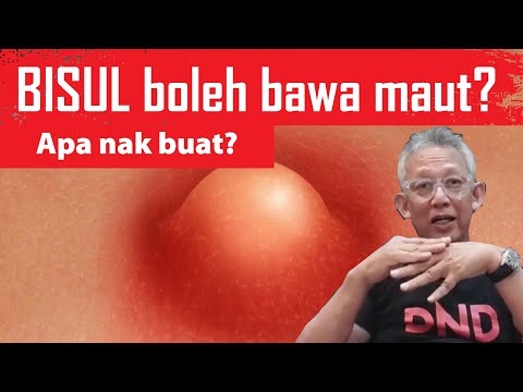 Video: Apakah juru masak membunuh dr asuh?