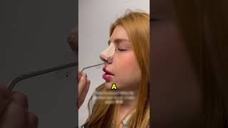 why they put this in your nose