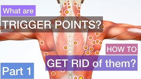 What are trigger points & how to get rid of them? Part 1 - How to self-manage your back pain?