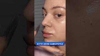 АКНЕ И ЖИРНЫЙ БЛЕСК? Вот решение! ТОП сыворотка + лайфхаки #Уход #Ретинол