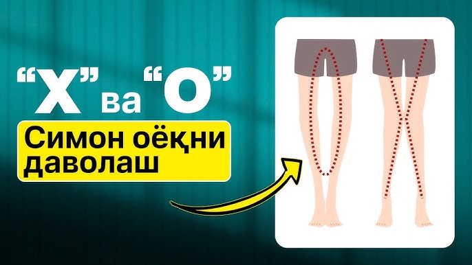 Semiz kubalik ayollarning erotik fotosuratlari