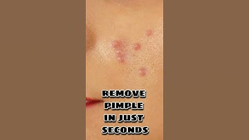How to remove pimple in snapseed in just few seconds #shorts #trending #snapseed #picsart