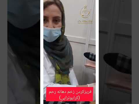 فیلم فریز کردن دهانه رحم کرایوتراپی