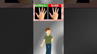 Who's rare😨 #challenges #riddles #shorts