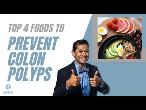Foods that prevent polyps: colon edition