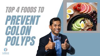 Foods that prevent polyps: colon edition Intestinal Polyps Diet