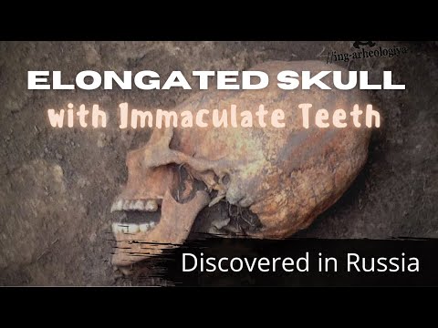 Elongated Skull with Immaculate Teeth Discovered in Russia