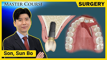 [Master Course Season2 - SURGERY] Various Soft Tissue Preservation & Augmentation Technique
