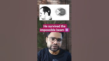 He survived a PROTON beam ⚛️