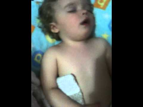 baby with Croup Stridor Barking Cough visual & audio sound - When to Hospitalize.