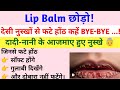 Lip Balm छोड़ो! देसी नुस्खों से फटे होंठ को कहें BYE-BYE | Cracked Lips Home Remedies #homeremedies