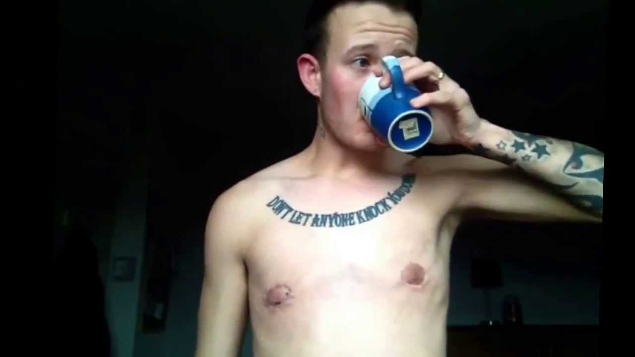 FTM UPDATE - 5 Weeks post op (periareolar surgery)