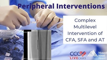 Complex Multilevel Intervention of CFA, SFA and AT - October 2020