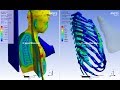 1st in the world ansys wb explicit dynamics  biomechanics simulation of leg kick in the chest