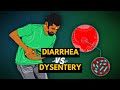 Differences between Diarrhea and Dysentery...