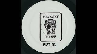 Nasenbluten - Skullbash - Bloody Fist
