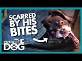 Owner Left Scarred after Dog's Possessive Bites | It's Me or the Dog