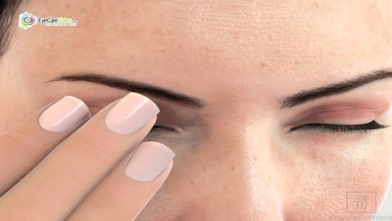 Dr. Michael Higgins - Dry Eye Disease