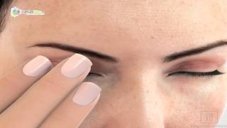 Dr. Michael Higgins - Dry Eye Disease