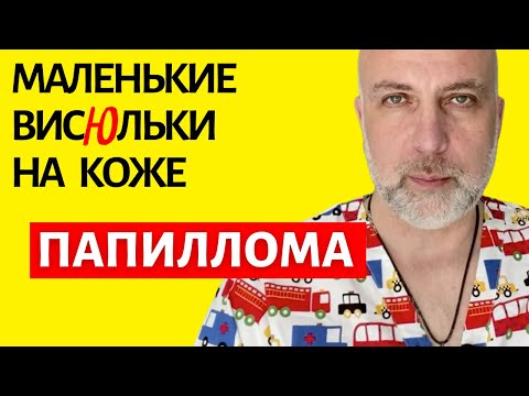 Вирус папилломы человека (ВПЧ) | Доктор Елизаров: Первая помощь и Здоровье кожи