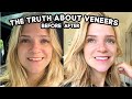 What They Don't Tell You About Getting Veneers: Pain, Cost, Is It Worth it?