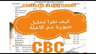 CBC - Complete Blood Count || تحليل صورة دم كاملة - تحليل الدم