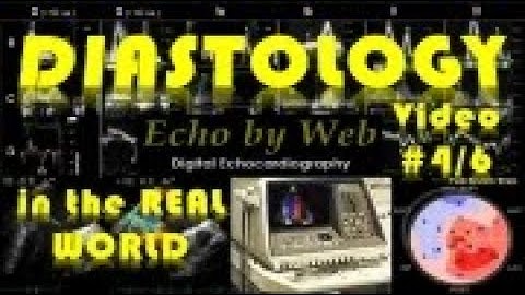 Echocardiographic analysis of LV diastolic function_Video 4