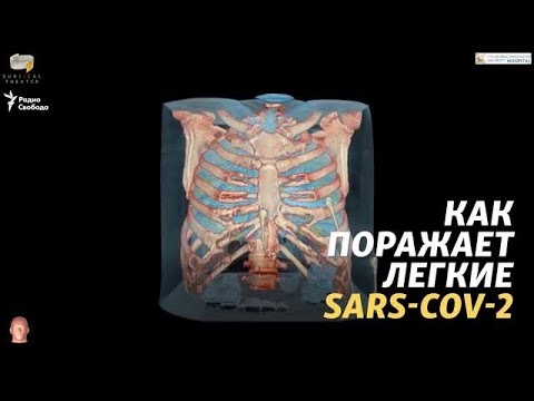 Как поражает легкие SARS-CoV-2