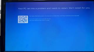 Windows Startup Repair Loop & Blue Screen Fix | Windows Won’t Start