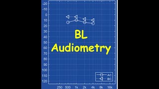 Brane Lab Audiometry How To Tutorial On Automated-Bekesy Testing