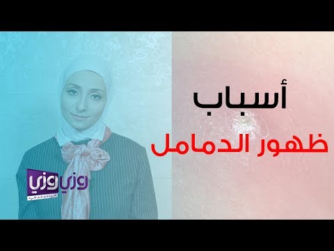 فيديو: هل الدمامل و الدمامل هي نفس الشيء؟